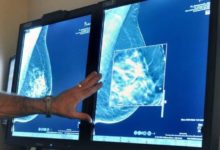 Breast cancer screening guidelines based on flawed Canadian study, new paper says-Milenio Stadium-Canada