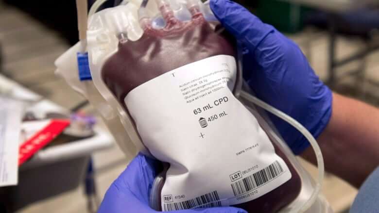 Canadian Blood Services to recommend end to ban on men who have sex with men donating blood-Milenio Stadium-Canada