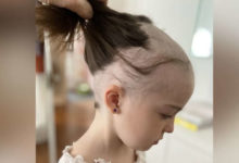 After she lost her hair from COVID-19, 7-year-old Regina girl excited for 1st vaccine dose-Milenio Stadium-Canada